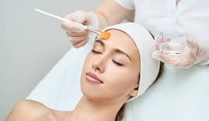 Chemical Peel